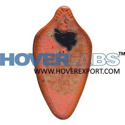 Liver Fluke Model